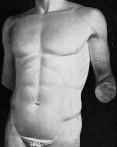 Attic - 5th century BC (first half)